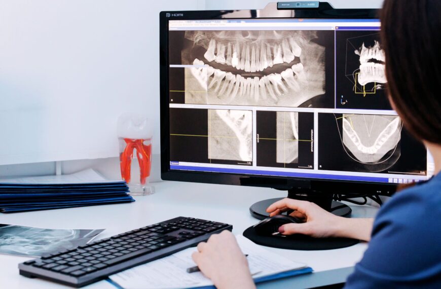 Radiographie dentaire affichée sur un écran d’ordinateur, montrant les dents de sagesse