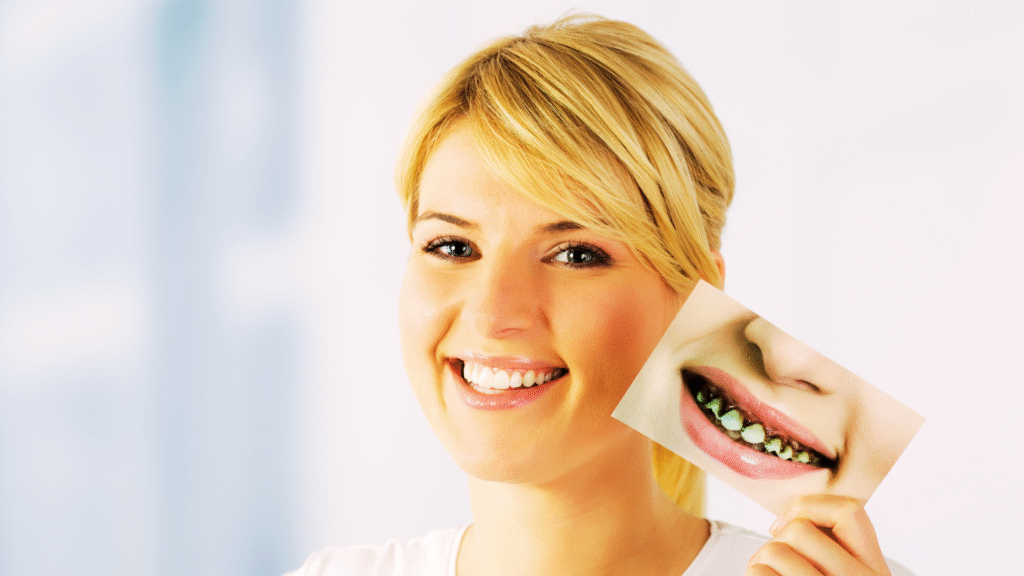 Jeune femme souriante tenant une photo montrant des dents pourries et sévèrement abîmées.