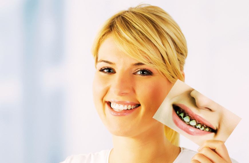 Jeune femme souriante tenant une photo montrant des dents pourries et sévèrement abîmées.